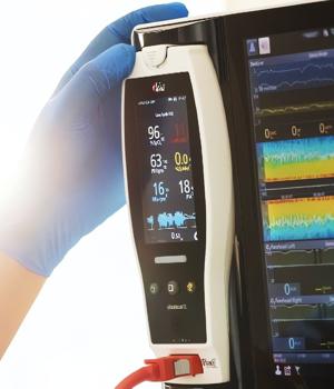 Medical device maker Masimo warns of cyberattack, manufacturing delays